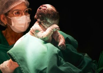Ostetrica con un neonato appena dato alla luce (Foto Pexels di Hannah Barata)